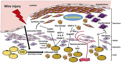 The Role of Perivascular Adipose Tissue in Non-atherosclerotic Vascular Disease